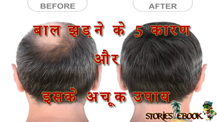 बाल झड़ने के 5 कारण और इसके अचूक उपाय || Hair fall causes and its best remedy
